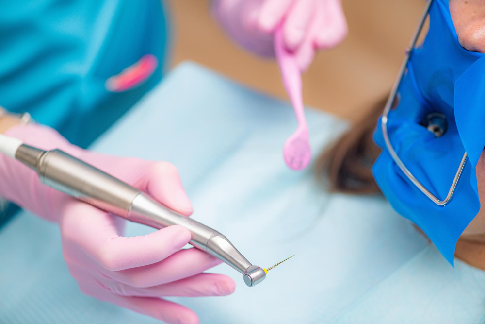 Dental pulp and dental root treatment (Endodontics)